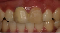 cosmetic dentistry clip