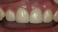 cosmetic dentistry clip