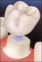 aesthetic dentistry crown-01-before