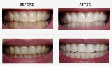 cosmetic dentistry clip