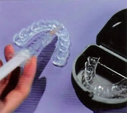 cosmetic dentistry clip