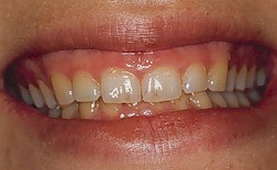 cosmetic dentistry