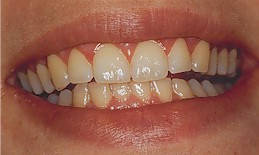 cosmetic dentistry