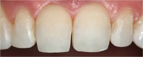 cosmetic dentistry clip