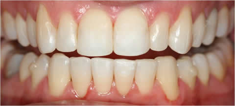 cosmetic dentistry clip