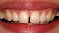 cosmetic dentistry