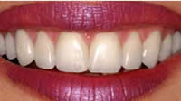 cosmetic dentistry