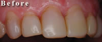 cosmetic dentistry