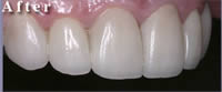 cosmetic dentistry