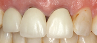 cosmetic dentistry