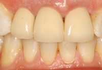 cosmetic dentistry