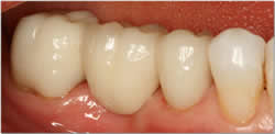 restorative-dentistry